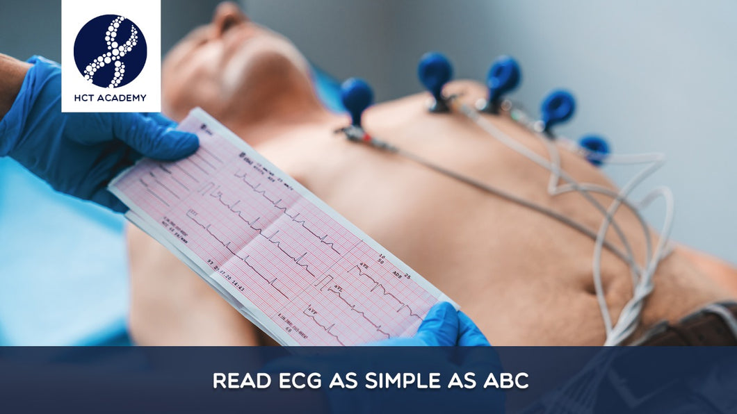 Read ECG as Simple as ABC